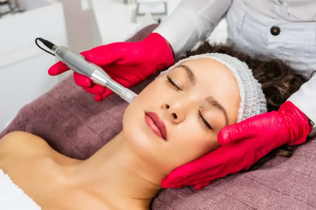 Microneedling Before and After Care Tips for Effective Results