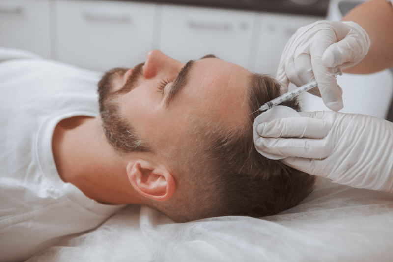 Portfolio 9 Hair Restoration | Aspire Aesthetics and Wellness